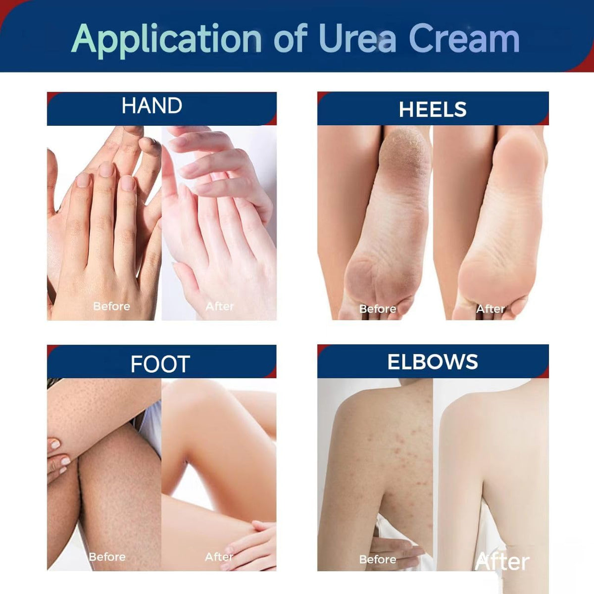 OUKEYA applying cream to hand and elbow showing smoothing benefit