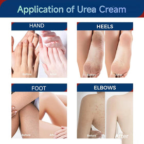OUKEYA applying cream to hand and elbow showing smoothing benefit