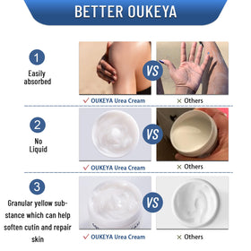 OUKEYA applied to heel demonstrating deep moisturization benefit