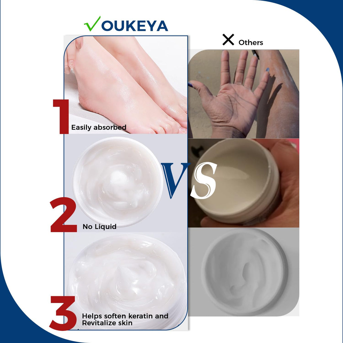Applying OUKEYA cream to elbow demonstrating skin-smoothing treatment benefit