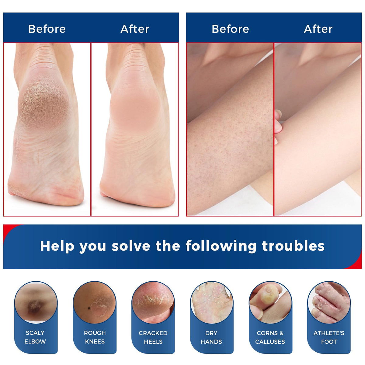 Feet wrapped in socks after OUKEYA application to boost overnight moisture
