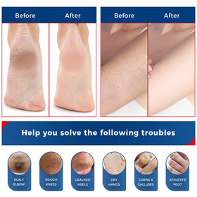 Feet wrapped in socks after OUKEYA application to boost overnight moisture