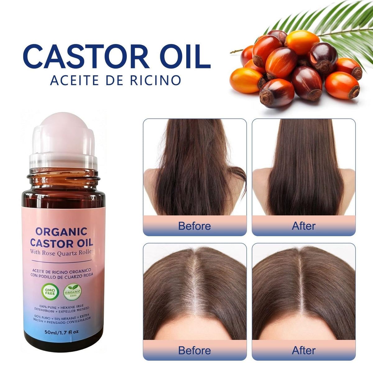 OUKPANE applying oil to hairline for localized scalp nourishment benefit
