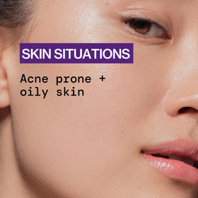 Pacifica label showing witch hazel and niacinamide, calms skin and fades marks