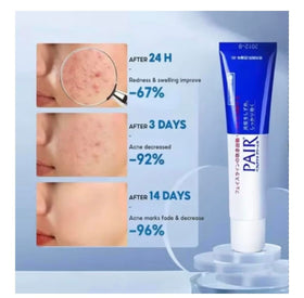 Generic Pair Acne cream packaging label close-up highlighting Japanese medicated formulation benefits
