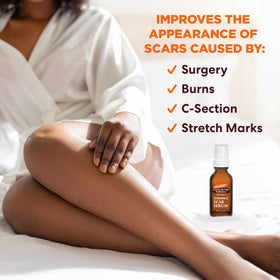 Palmer's scar serum texture close-up highlights lightweight, fast-absorbing oil