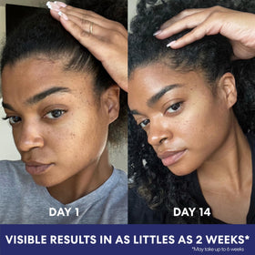 Palmer's illustration of fading dark spots before and after consistent use
