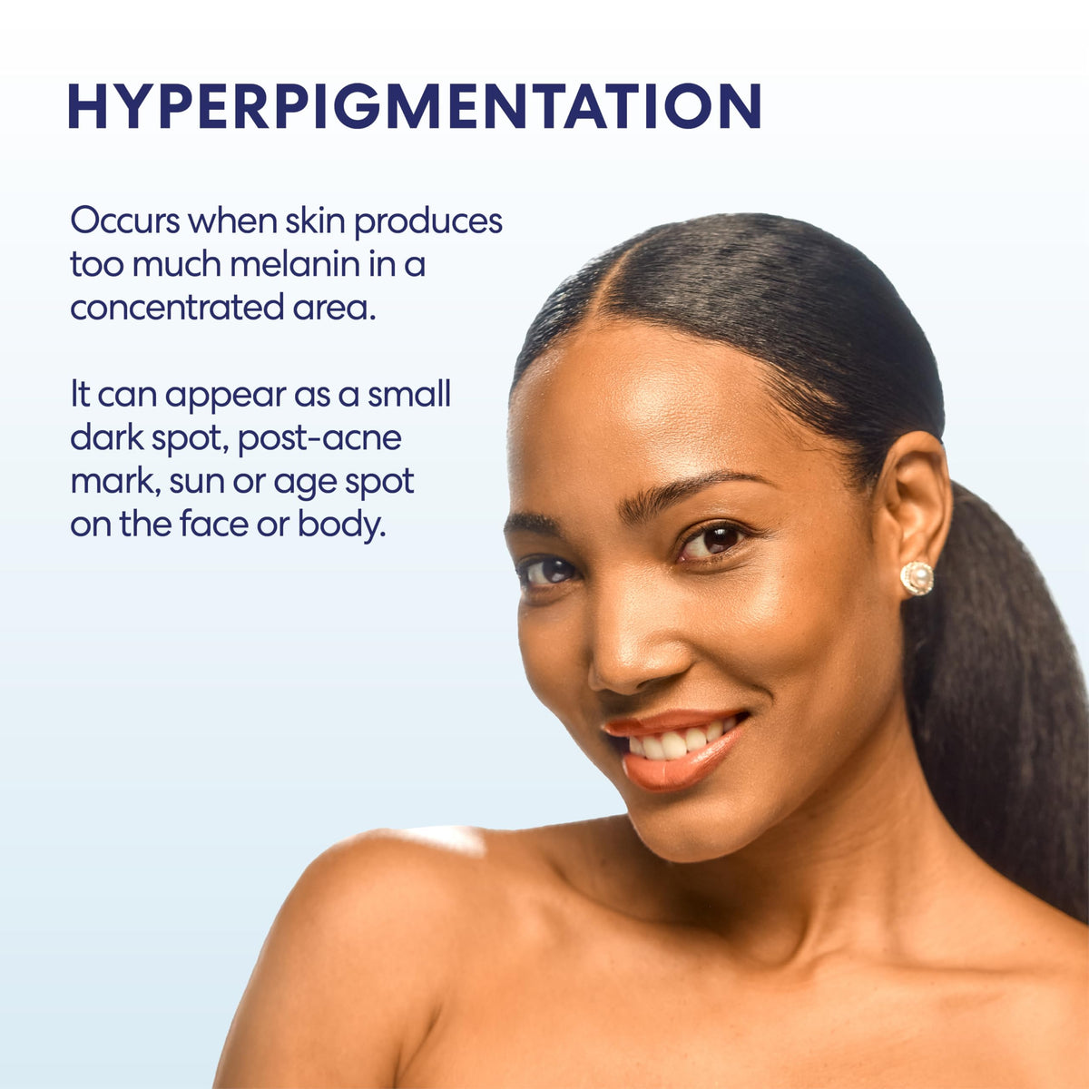 Palmer's cream applied to forearm dark spot showing targeted treatment benefit