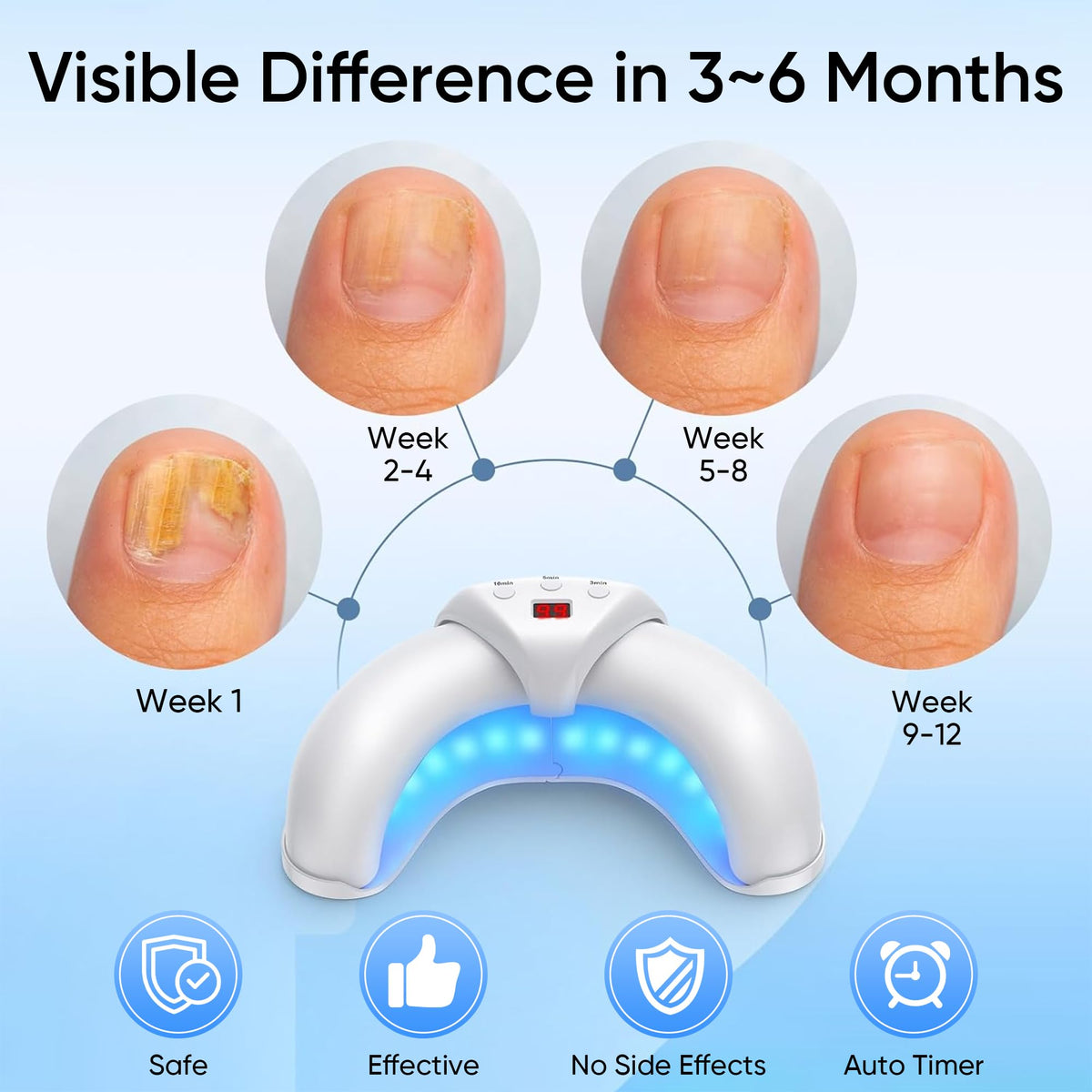 PANIMOSI device treating toenails hands-free for convenient at-home care