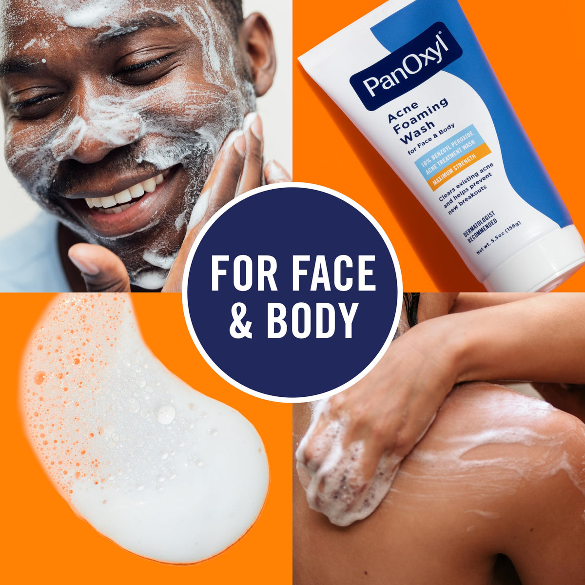 Applying PanOxyl to face in routine to reduce acne and unclog pores