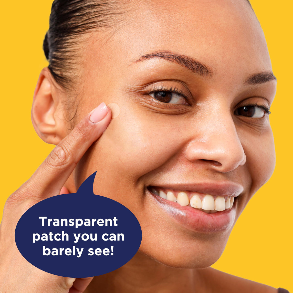 PanOxyl patch applied to cheek demonstrating discreet protection