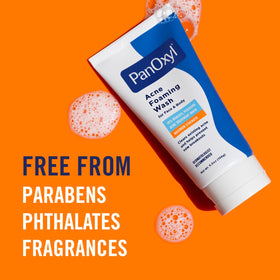 Using PanOxyl on back to treat body breakouts and stubborn acne