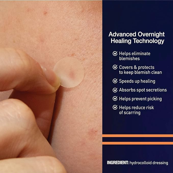 PanOxyl patch applied on cheek protecting blemish and preventing picking