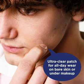 PanOxyl patch applied on cheek under makeup, discreet coverage benefit