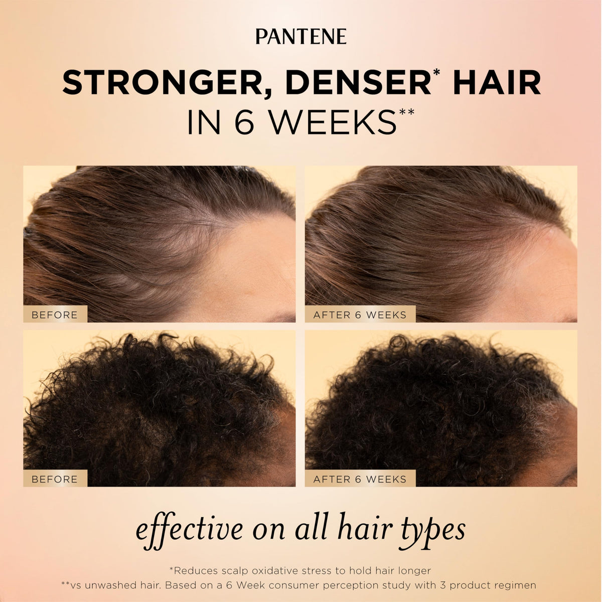 Pantene root & scalp serum dropper close-up for targeted nourishment