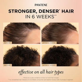 Pantene root & scalp serum dropper close-up for targeted nourishment