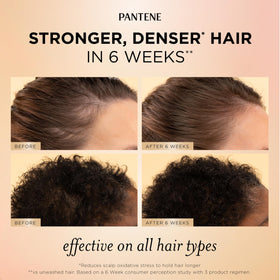 Pantene applying serum on scalp sections for targeted root nourishment