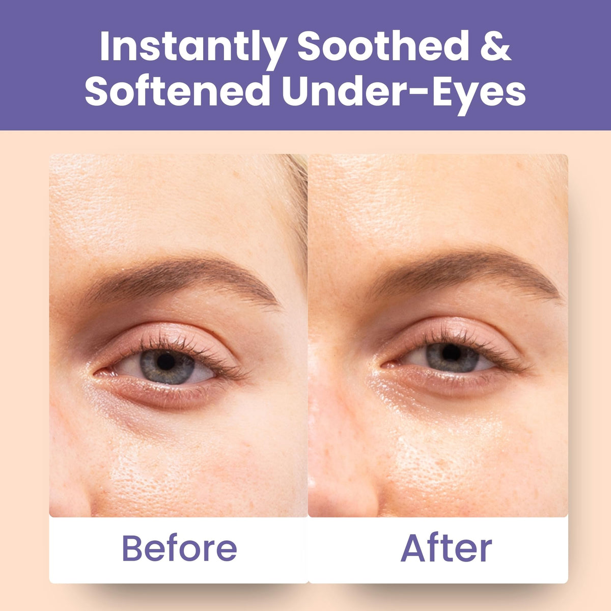 Patchology lifestyle spa setup suggesting relaxing eye treatment