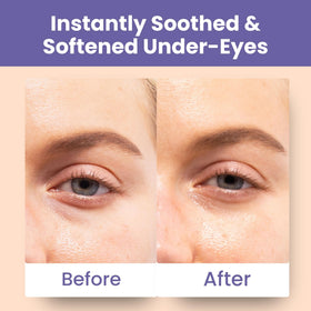 Patchology lifestyle spa setup suggesting relaxing eye treatment