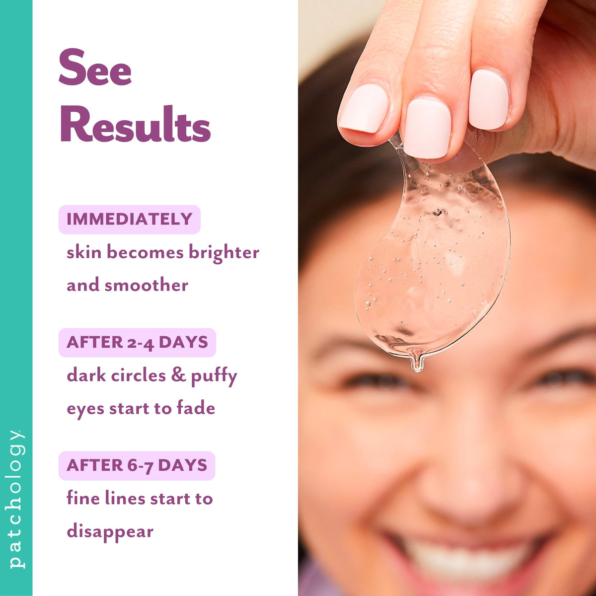 Patchology gel patches applied under eye illustrating soothing, refreshing effect