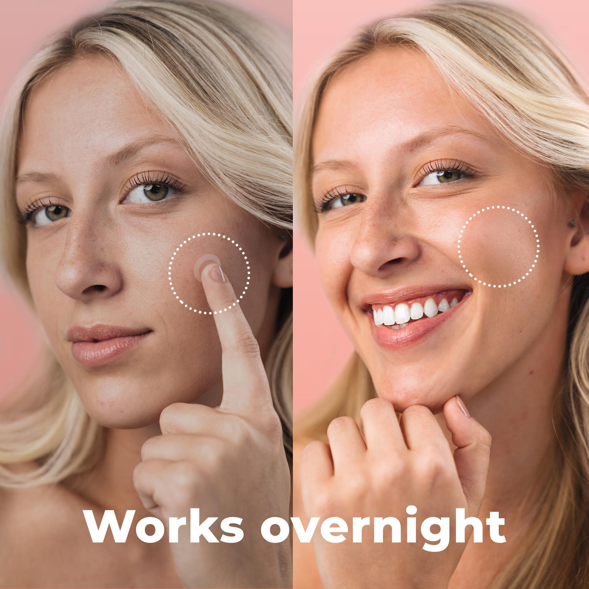 PatchRx applied on cheek demonstrating discreet protection