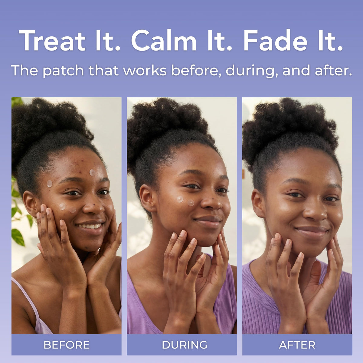 PatchRx three sizes of patches displayed to fit different blemish sizes