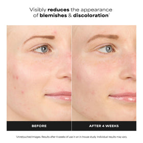 Paula's Choice bottle beside moisturizer demonstrating mixable booster benefit