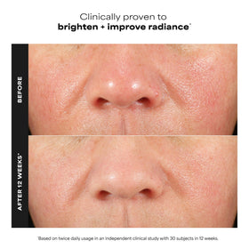 Paula's Choice dropper dispensing serum for precise application and control