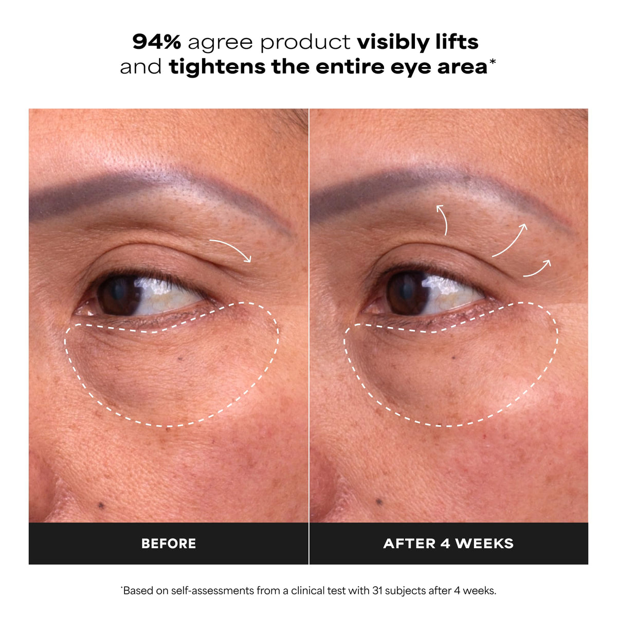Paula's Choice cooling applicator close-up delivering immediate soothing and depuffing