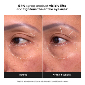 Paula's Choice cooling applicator close-up delivering immediate soothing and depuffing