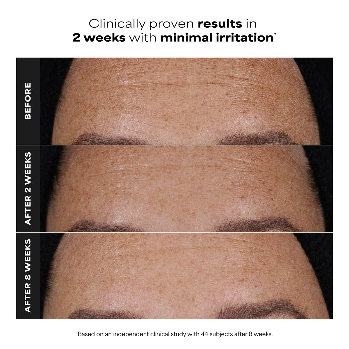 Paula's Choice label close-up highlighting dual-retinoid formulation benefits