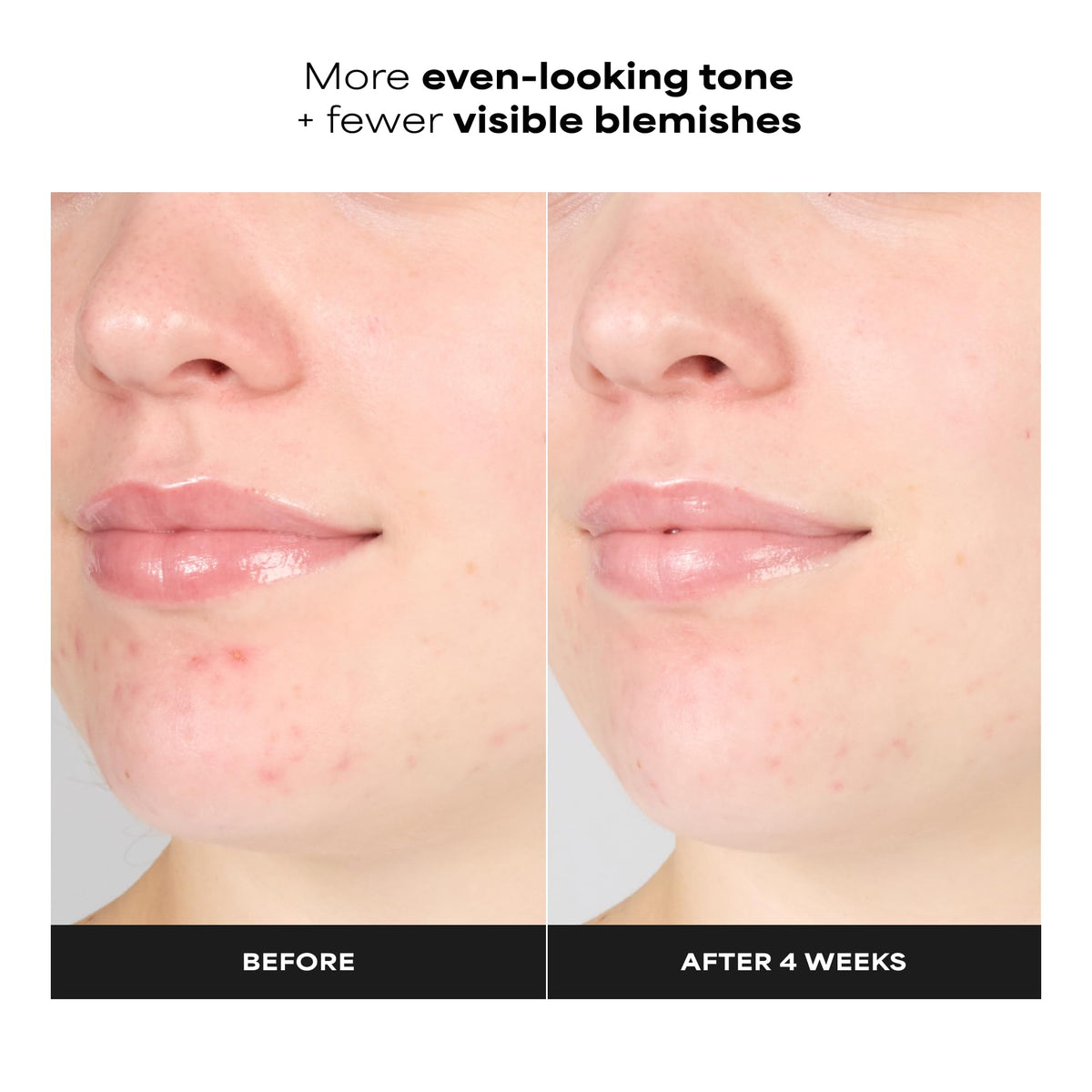 Paula's Choice gel dispenser with texture visible for gentle exfoliation