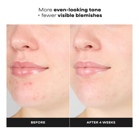 Paula's Choice gel dispenser with texture visible for gentle exfoliation