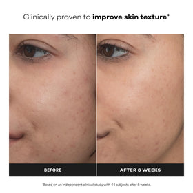 Paula's Choice serum texture on skin demonstrating lightweight absorption