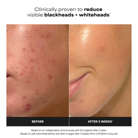 Paula's Choice pad texture close-up showing gentle exfoliation fibers for smooth skin