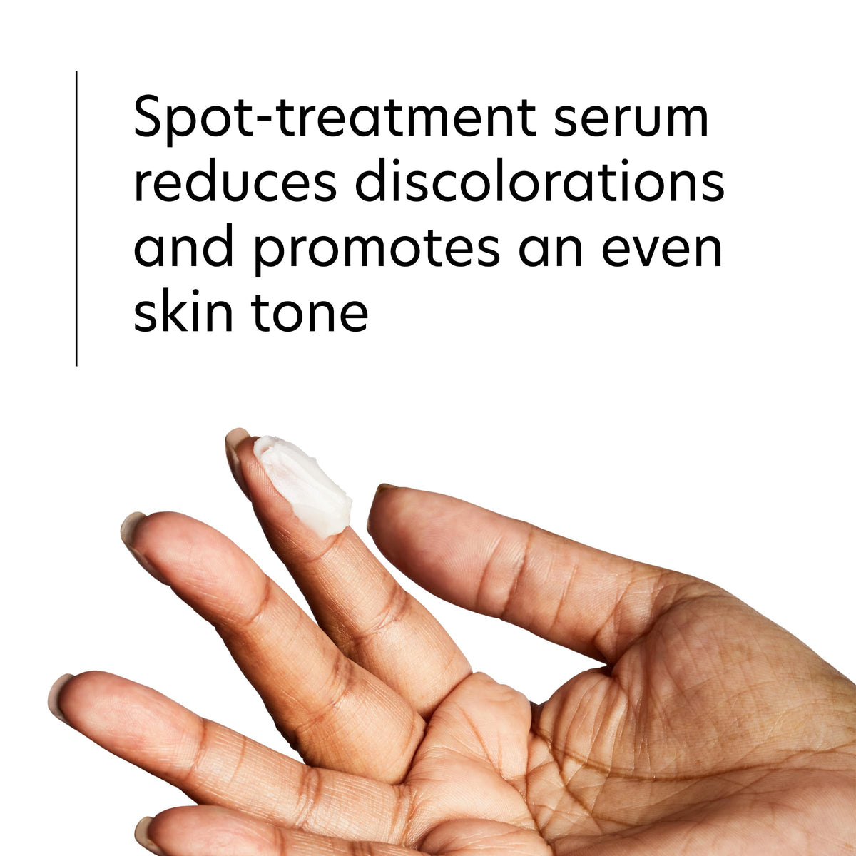 PCA SKIN before and after comparison showing reduced spot contrast over time