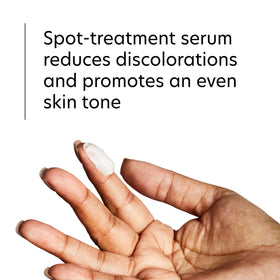 PCA SKIN before and after comparison showing reduced spot contrast over time