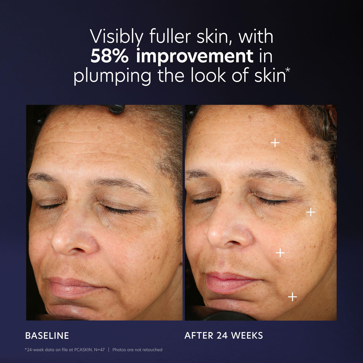 PCA SKIN illustrative before and after framing visible firmness benefit