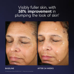 PCA SKIN illustrative before and after framing visible firmness benefit