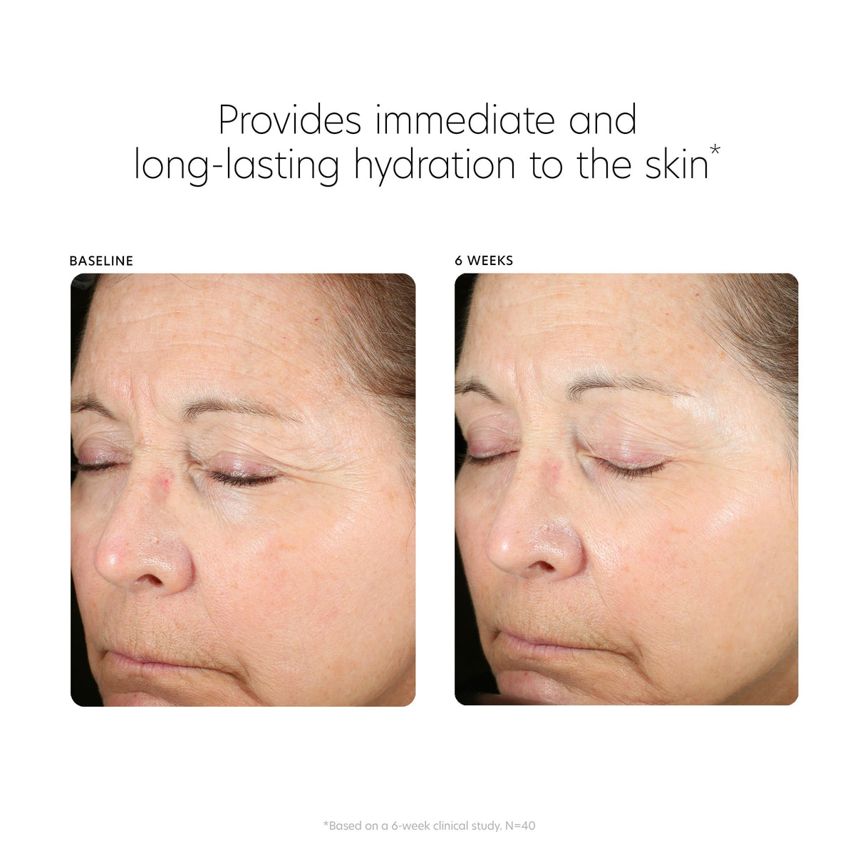 PCA SKIN bottle with ceramide graphic illustrating barrier-supporting benefit