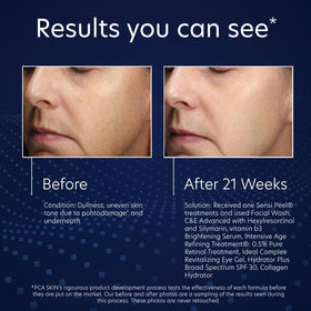 PCA SKIN application on face demonstrating easy layering benefit