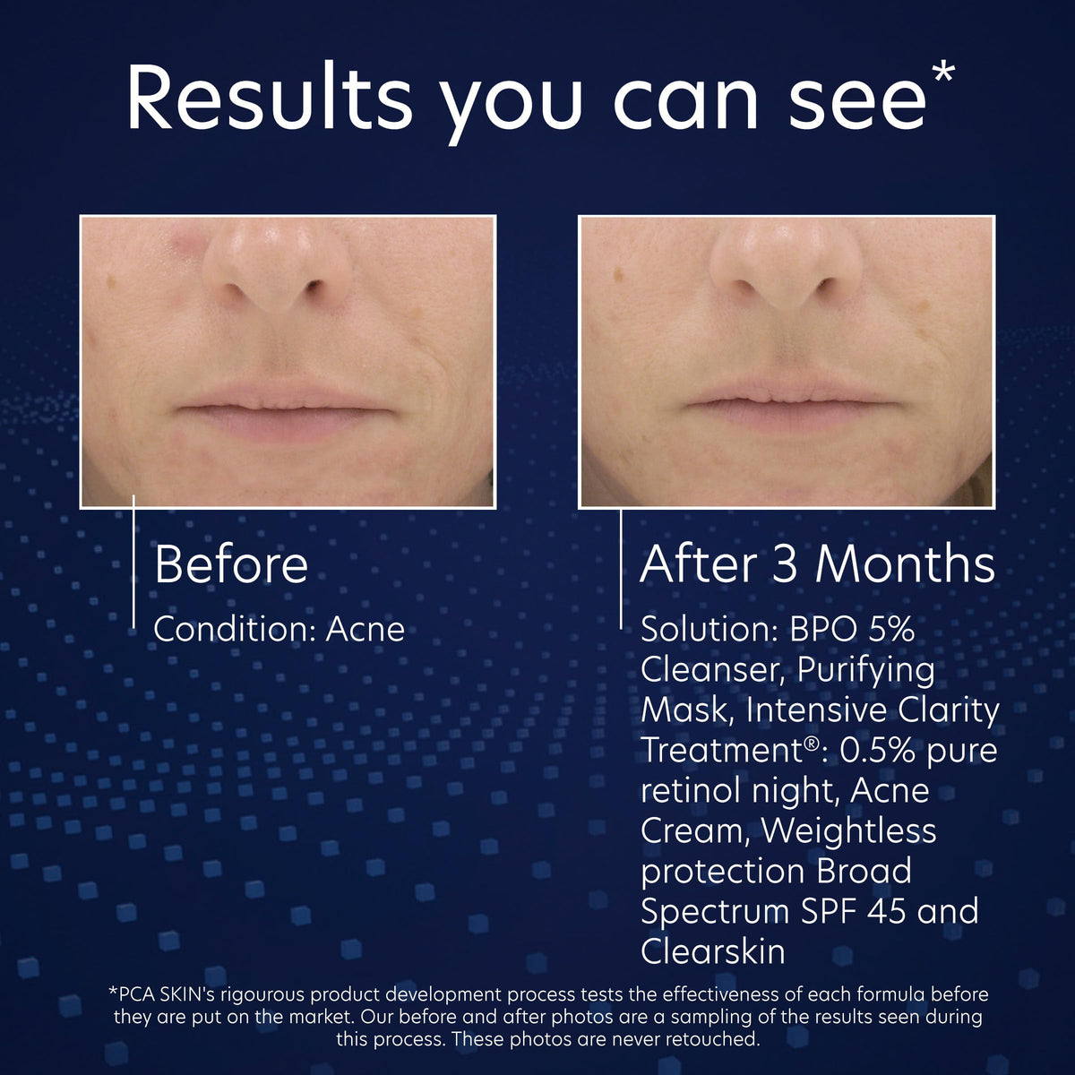 PCA SKIN wash in bathroom setting showing daily skincare integration