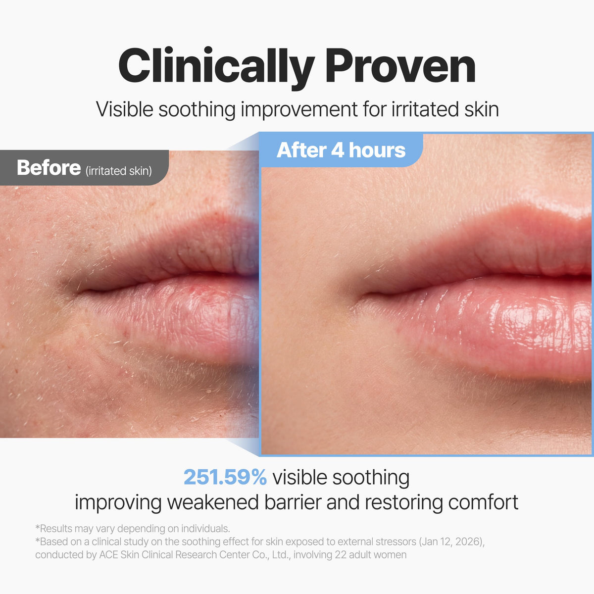 P.CALM label close-up displaying key actives and transparency in formulation benefits