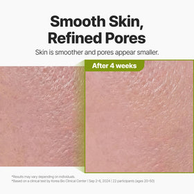 P.CALM skin after rinse showing balanced hydration and reduced shine