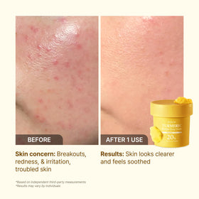 P.CALM label detail highlighting ingredients and gentle formulation