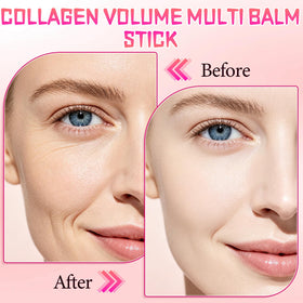 Generic PDRN Pink Collagen applied to lips and smile lines for plumping effect