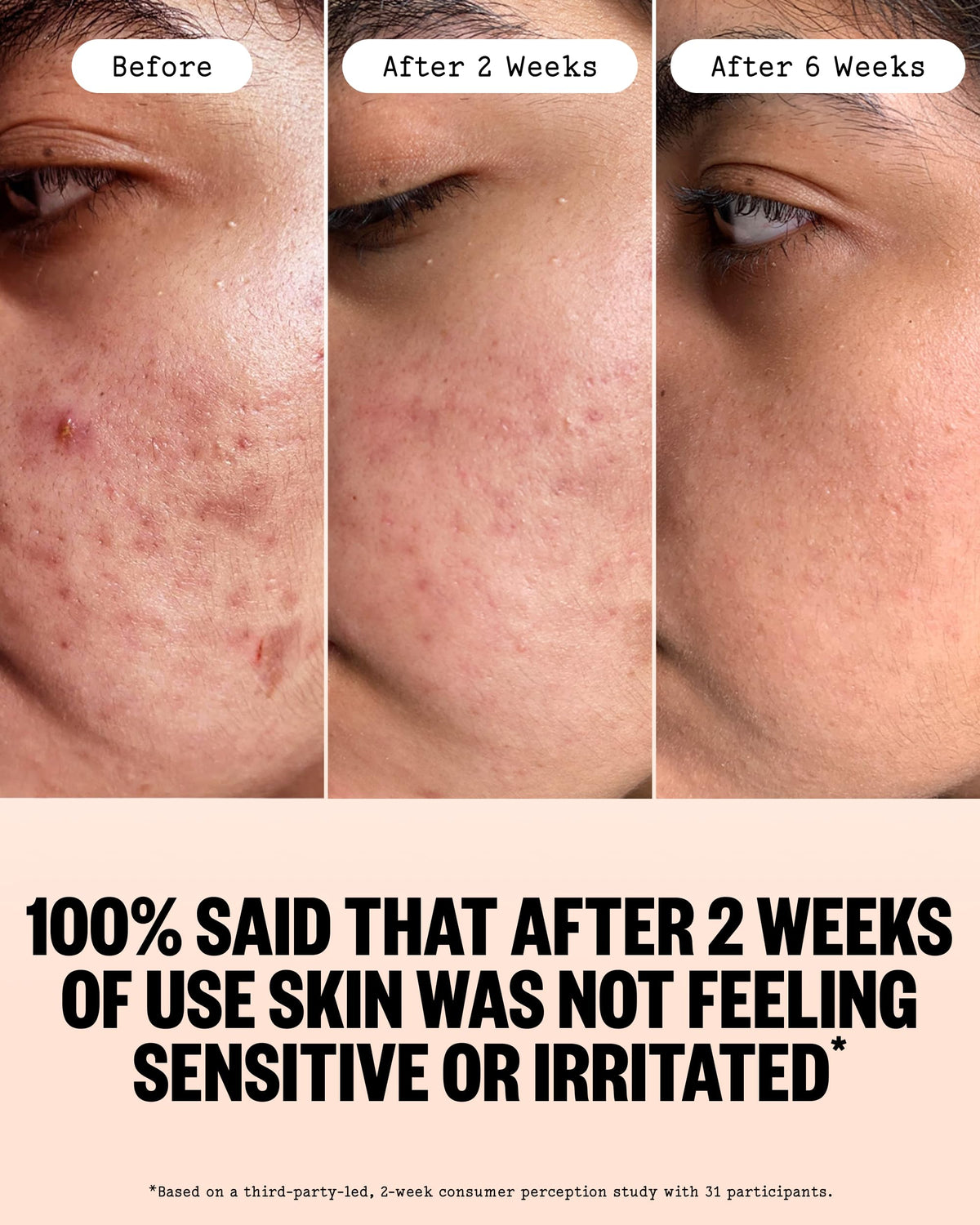 PEACE OUT pipette dispensing serum highlighting controlled application and precision