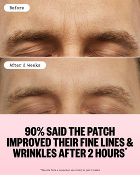 PEACE OUT patch applied to crow’s feet area demonstrating targeted smoothing