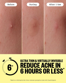 PEACE OUT patch on skin nearly invisible for daytime protection