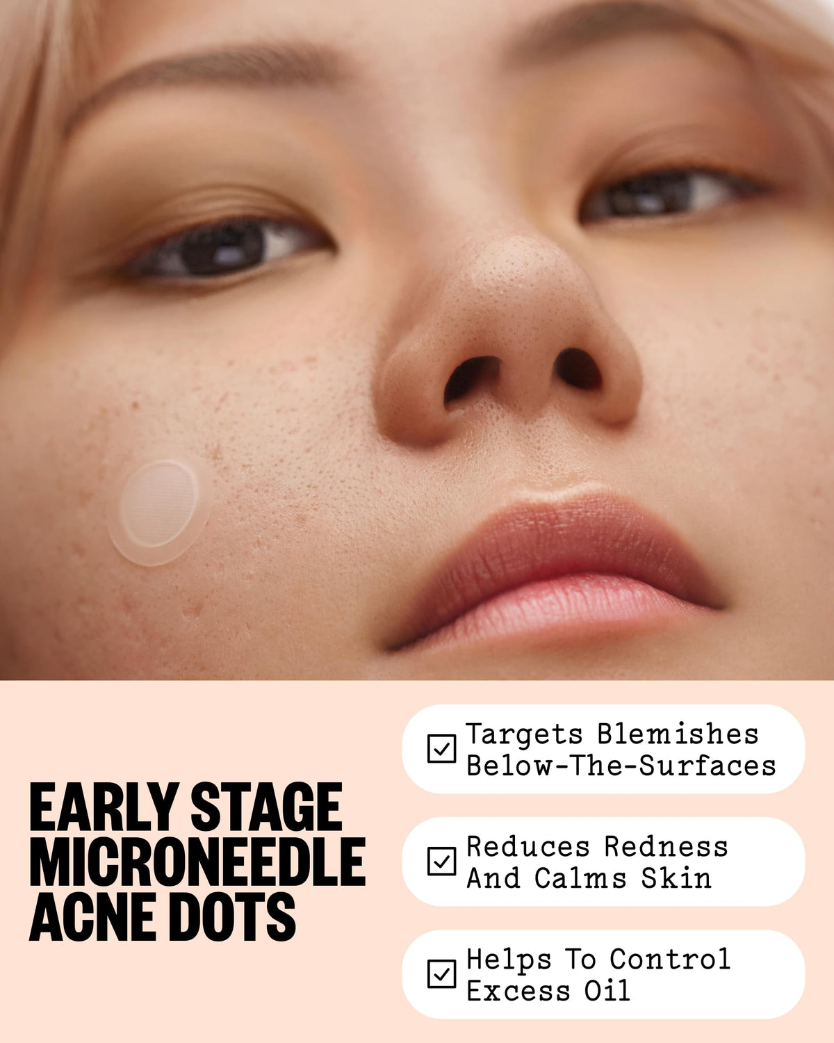 PEACE OUT close-up of dissolvable microneedle texture delivering actives under skin